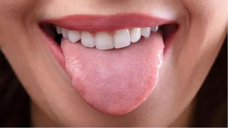 ಬಿಳಿ, ಕೆಂಪು, ಗುಳ್ಳೆಗಳು: ನಾಲಿಗೆಯ ಬದಲಾವಣೆಗಳ ಅರ್ಥ ಏನು?